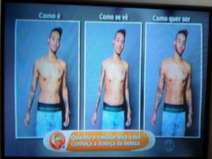 doença da beleza